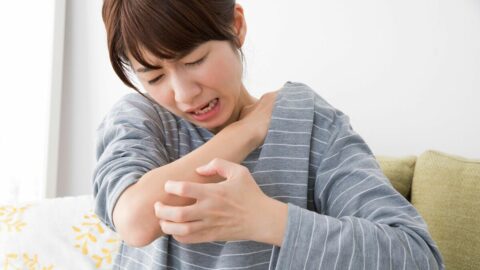 繰り返すかゆみ｢大人の蕁麻疹｣8割がこのタイプ | ｢病気｣と｢症状｣の対処法 | 東洋経済オンライン