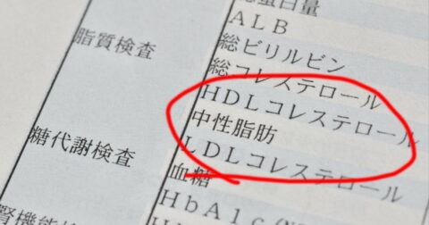 【医者が教える】「コレステロール」より注意すべき栄養とは？ – 医者が教える 栄養学的に正しい最高の食事術