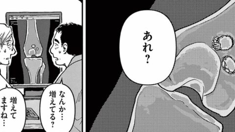 ｢大腿骨にカニが寄生｣　気味悪がった”中年患者”の境地　漫画｢まどいのいきもの ―銀河生物観察記―｣（第1集 第2話） | ライフ | 東洋経済オンライン